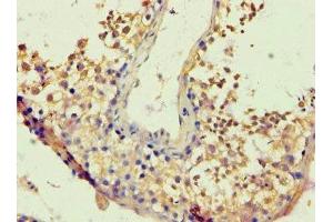 Immunohistochemistry (IHC) image for anti-BTB and CNC Homology 1, Basic Leucine Zipper Transcription Factor 1 (BACH1) (AA 1-320) antibody (ABIN7172717)