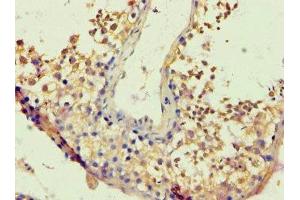 Immunohistochemistry of paraffin-embedded human testis tissue using ABIN7172717 at dilution of 1:100