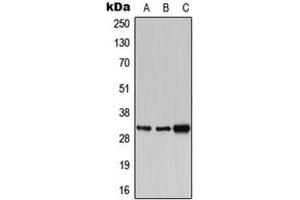 Western blot analysis of PBR expression in HEK293T (A), SP2/0 (B), PC12 (C) whole cell lysates. (TSPO 抗体  (C-Term))