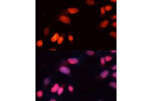 Immunofluorescence analysis of NIH-3T3 cells using SIRT1 Polyclonal Antibody (ABIN3020730, ABIN3020731, ABIN3020732, ABIN1513524 and ABIN6213695) at dilution of 1:100 (40x lens). (SIRT1 抗体)