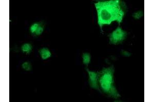 Immunofluorescence (IF) image for anti-ATPase, H+ Transporting, Lysosomal 56/58kDa, V1 Subunit B1 (ATP6V1B1) antibody (ABIN1496775) (ATP6V1B1 抗体)