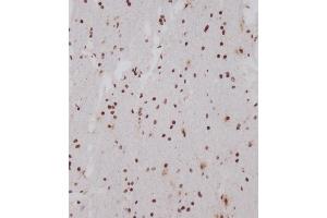 Immunohistochemical analysis of (ABIN1539554 and ABIN2849696) on paraffin-embedded human brain tissue was performed on the Leica®BOND RXm. (OTUD7A 抗体  (N-Term))
