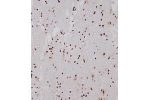 Immunohistochemical analysis of (ABIN1539554 and ABIN2849696) on paraffin-embedded human brain tissue was performed on the Leica®BOND RXm. (OTUD7A 抗体  (N-Term))
