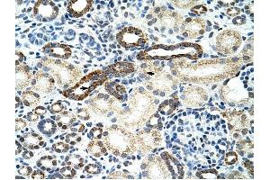 HNRPF antibody was used for immunohistochemistry at a concentration of 4-8 ug/ml to stain Epithelial cells of renal tubule (arrows! (HNRNPF 抗体  (C-Term))