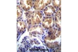 Immunohistochemistry (IHC) image for anti-Transient Receptor Potential Cation Channel, Subfamily M, Member 6 (TRPM6) antibody (ABIN3003652) (TRPM6 抗体)