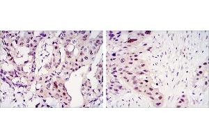 Immunohistochemistry (IHC) image for anti-Signal Transducer and Activator of Transcription 3 (Acute-Phase Response Factor) (STAT3) antibody (ABIN933087)