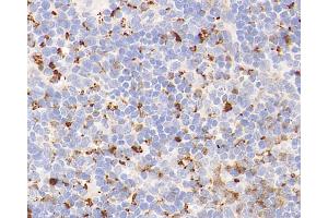 Immunohistochemistry analysis of parafffin-embedded mouse spleen using Lysozyme Polyclonal Antibody at dilution of 1:400. (LYZ 抗体)