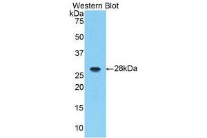 Western Blotting (WB) image for anti-Interleukin-1 Receptor-Associated Kinase 1 (IRAK1) (AA 212-440) antibody (ABIN3206503) (IRAK1 抗体  (AA 212-440))