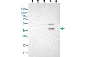 Western blot analysis of Lane 1: RT-4, Lane 2: U-251 MG, Lane 3: Human Plasma, Lane 4: Liver, Lane 5: Tonsil with WNT7A polyclonal antibody . (WNT7A 抗体)