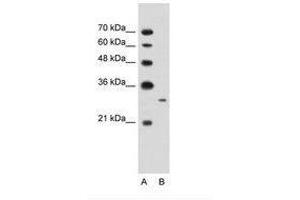 Image no. 2 for anti-MAP3K7 C-Terminal Like (MAP3K7CL) (AA 151-200) antibody (ABIN203427)