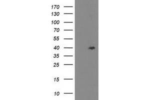 Western Blotting (WB) image for anti-TBC1 Domain Family, Member 21 (TBC1D21) antibody (ABIN1501317) (TBC1D21 抗体)