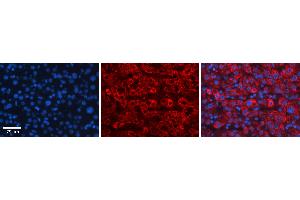 Rabbit Anti-FBXO21 Antibody Catalog Number: ARP43176_P050 Formalin Fixed Paraffin Embedded Tissue: Human Liver Tissue Observed Staining: Cytoplasm in hepatocytes Primary Antibody Concentration: 1:100 Other Working Concentrations: 1:600 Secondary Antibody: Donkey anti-Rabbit-Cy3 Secondary Antibody Concentration: 1:200 Magnification: 20X Exposure Time: 0. (FBXO21 抗体  (C-Term))