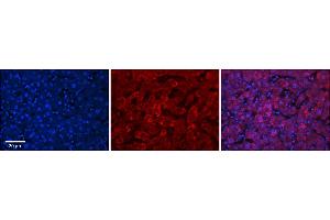 Rabbit Anti-UGT1A7 Antibody      Formalin Fixed Paraffin Embedded Tissue: Human Adult Liver   Observed Staining: Cytoplasm in hepatocytes, strong signal, wide tissue distribution  Primary Antibody Concentration: 1:100  Secondary Antibody: Donkey anti-Rabbit-Cy3  Secondary Antibody Concentration: 1:200  Magnification: 20X  Exposure Time: 0. (UGT1A7 抗体  (N-Term))