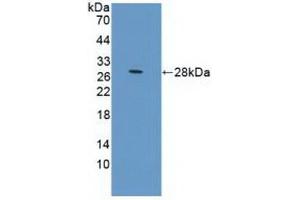 Detection of Recombinant PRLR, Human using Polyclonal Antibody to Prolactin Receptor (PRLR) (Prolactin Receptor 抗体  (AA 25-234))
