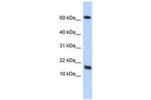 Image no. 1 for anti-Chromosome 4 Open Reading Fram 46 (C4orf46) (AA 35-84) antibody (ABIN6741114) (C4orf46 抗体  (AA 35-84))