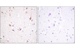 Immunohistochemistry analysis of paraffin-embedded human brain tissue, using Mst1/2 (Ab-183) Antibody. (MST1/MST2 (AA 149-198) 抗体)