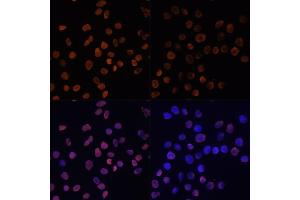 Immunofluorescence analysis of HeLa cells using Acetyl-Histone H2A-K5 antibody (ABIN7267722) at dilution of 1:100. (Histone H2A 抗体  (acLys5))