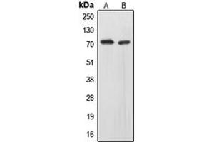 Western blot analysis of EOMES expression in HepG2 (A), IMR32 (B) whole cell lysates. (EOMES 抗体  (N-Term))