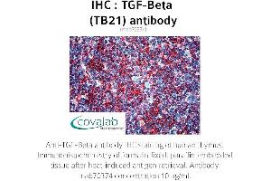 Image no. 1 for anti-TGF-beta (TGFb) antibody (ABIN1723276) (TGF-beta 抗体)