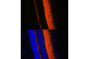 Immunofluorescence analysis of mouse eye using SYT1 Rabbit pAb (ABIN3021249, ABIN3021250, ABIN3021251 and ABIN6214085) at dilution of 1:100 (40x lens). (SYT1 抗体  (AA 1-422))