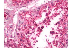Immunohistochemistry (IHC) image for anti-MIS12, MIND Kinetochore Complex Component, Homolog (MIS12) (AA 1-50) antibody (ABIN2625406)