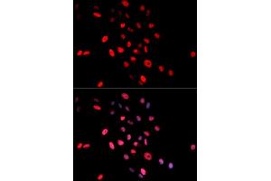 Immunofluorescence (IF) image for anti-Jun Proto-Oncogene (JUN) (pSer63) antibody (ABIN1870292) (C-JUN 抗体  (pSer63))