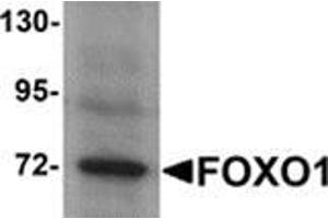 Western blot analysis of FOXO1 in Hela cell lysate with FOXO1 antibody at 1 μg/ml. (FOXO1 抗体  (N-Term))