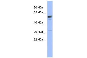 WB Suggested Anti-ZNF146 Antibody Titration:  0. (ZNF146 抗体  (Middle Region))