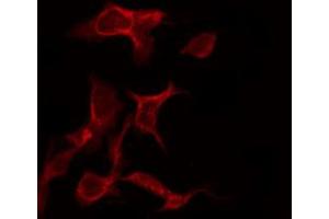 ABIN6267267 staining SK-OV3 by IF/ICC. (EGFR 抗体  (pSer695))