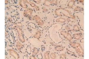 Immunohistochemistry (IHC) image for anti-Complement Component 1, Q Subcomponent, A Chain (C1QA) (AA 28-245) antibody (ABIN7435415)