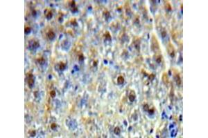Used in DAB staining on fromalin fixed paraffin-embedded Liver tissue (PSIP1 抗体  (AA 311-469))