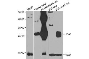 Western blot analysis of extracts of various cell lines, using HBA1 antibody (ABIN4903869) at 1:1000 dilution.