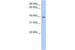 WB Suggested Anti-LIX1L Antibody Titration: 0. (LIX1L 抗体  (N-Term))