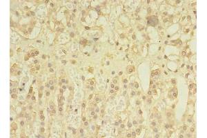 Immunohistochemistry (IHC) image for anti-Sprouty Homolog 1, Antagonist of FGF Signaling (SPRY1) (AA 1-178) antibody (ABIN7166148)