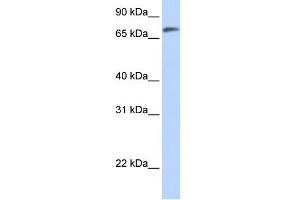 WB Suggested Anti-C14orf37 Antibody Titration:  0. (C14ORF37 抗体  (N-Term))