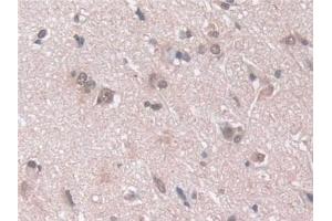Immunohistochemistry (IHC) image for anti-Proteasome Subunit alpha 5 (PSMA5) (AA 1-241) antibody (ABIN7441322)