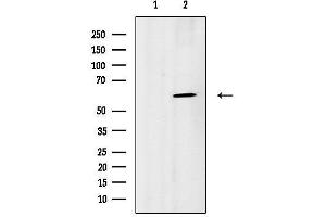 anti-beta-1,4-N-Acetyl-Galactosaminyl Transferase 1 (B4GALNT1) (Internal Region) antibody