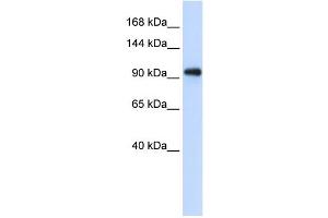 WB Suggested Anti-EXOSC10 Antibody Titration:  0. (EXOSC10 抗体  (C-Term))