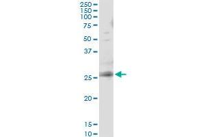 Immunoprecipitation of RAB3B transfected lysate using anti-RAB3B monoclonal antibody and Protein A Magnetic Bead , and immunoblotted with RAB3B MaxPab rabbit polyclonal antibody. (RAB3B 抗体  (AA 120-219))