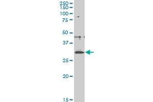 CITED1 monoclonal antibody (M03), clone 5H6 Western Blot analysis of CITED1 expression in A-431 . (CITED1 抗体  (AA 94-193))