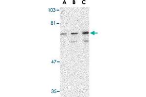 Western blot analysis of PTPN11 in mouse skeletal muscle tissue lysate with PTPN11 polyclonal antibody  at (A) 0.