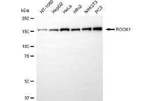 anti-rho-Associated, Coiled-Coil Containing Protein Kinase 1 (ROCK1) antibody
