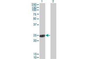 Western Blot analysis of COMT expression in transfected 293T cell line by COMT monoclonal antibody (M01), clone 1G4-1A1. (COMT 抗体  (AA 1-182))