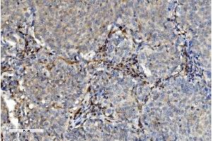 IHC analysis of PNP using anti-PNP antibody (ABIN7602997).