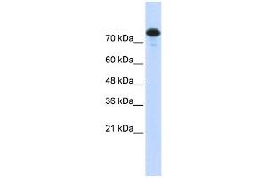 WB Suggested Anti-WWP2 Antibody Titration:  0. (WWP2 抗体  (Middle Region))
