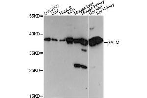 Western blot analysis of extracts of various cell lines, using GALM antibody (ABIN6292969) at 1:3000 dilution. (GALM 抗体)