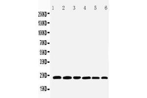 Anti-SNAP23 antibody, Western blotting Lane 1: Rat Spleen Tissue Lysate Lane 2: Rat testis Tissue Lysate Lane 3: Rat Ovary Tissue Lysate Lane 4: HELA Cell Lysate Lane 5: MCF-7 Cell Lysate Lane 6: SKOV Cell Lysate (SNAP23 抗体  (C-Term))