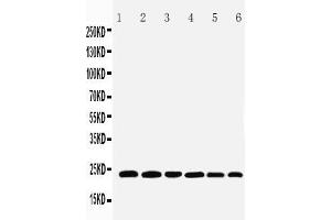 Anti-SNAP23 antibody, Western blotting Lane 1: Rat Spleen Tissue Lysate Lane 2: Rat testis Tissue Lysate Lane 3: Rat Ovary Tissue Lysate Lane 4: HELA Cell Lysate Lane 5: MCF-7 Cell Lysate Lane 6: SKOV Cell Lysate