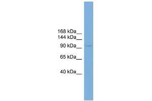 WB Suggested Anti-PIWIL4 Antibody Titration: 0. (PIWIL4 抗体  (N-Term))