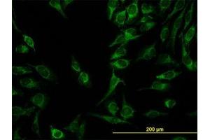 Image no. 4 for anti-Chromosome 21 Open Reading Frame 33 (C21orf33) (AA 188-269) antibody (ABIN599034) (C21orf33 抗体  (AA 188-269))